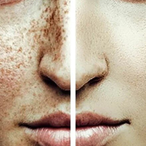 Применение